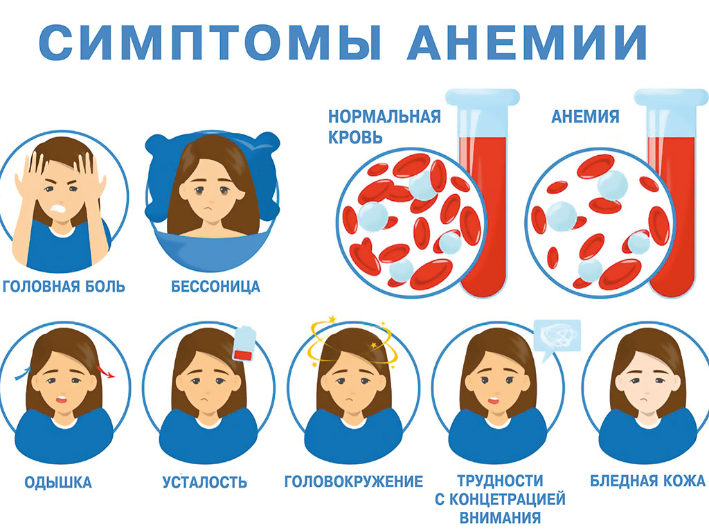 Профилактика железодефицитной анемии