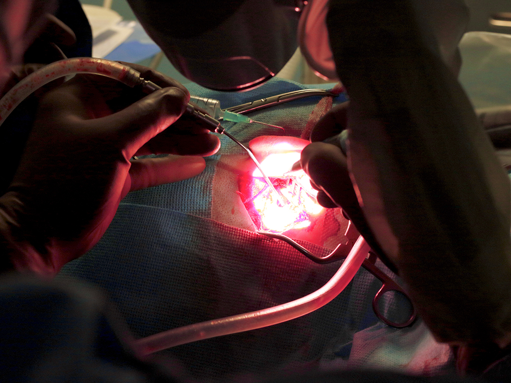 What do apartment renovation and ear surgeries have in common?