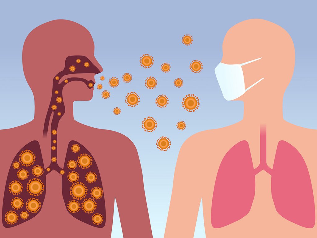 Туберкулез – жұқпалы дерт