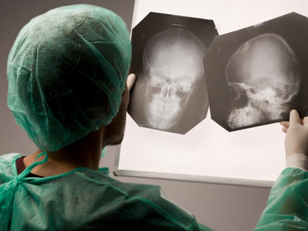 51-летнему мужчине провели операцию по пластике дефекта черепа в рамках ОСМС