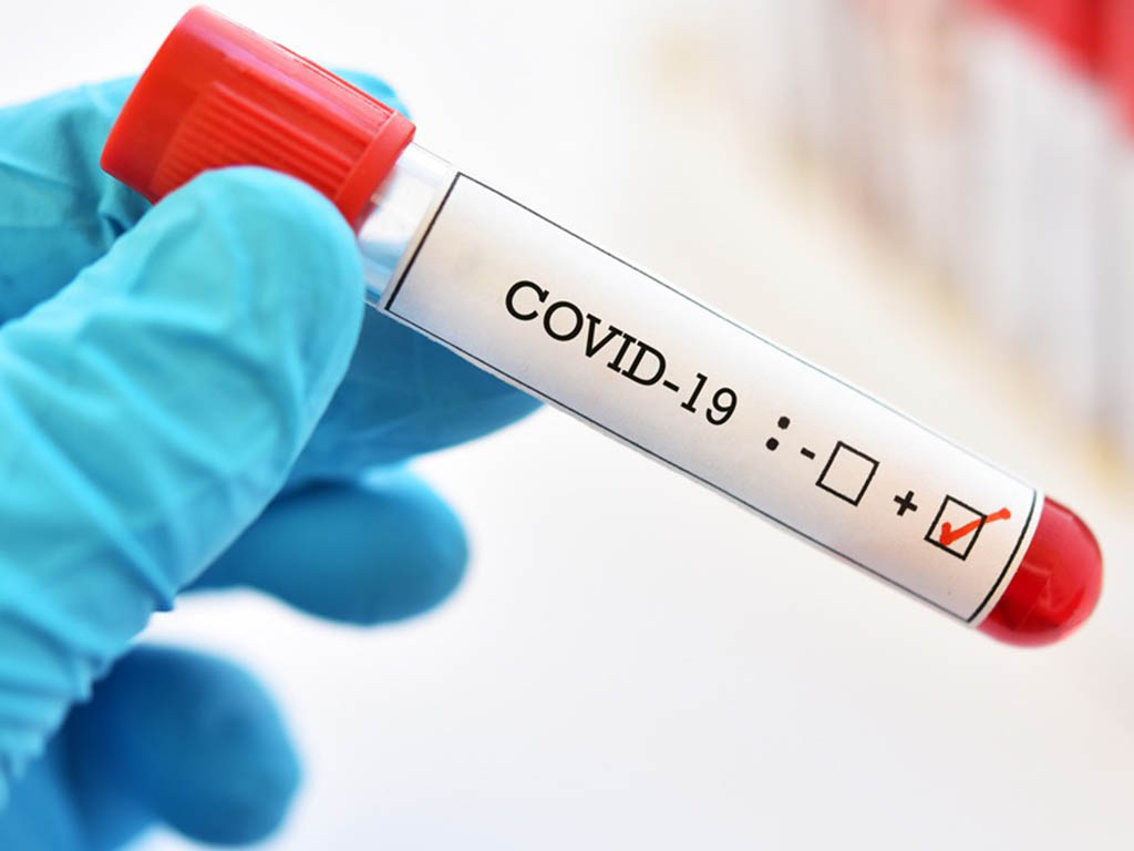 Жетісуда оқушылар арасында коронавирустық инфекциямен сырқаттанудың 583 фактісі тіркелген